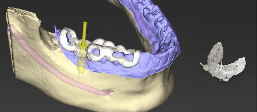 CBCT & Tarama